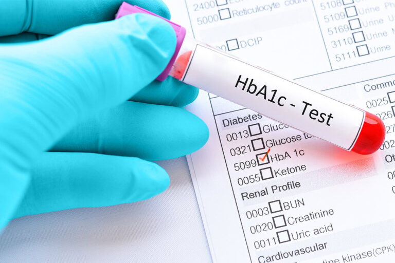آزمایش هموگلوبین A1C چیست؟