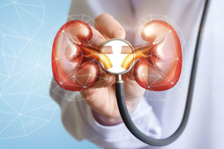 مقایسه اثر سولامر و کربنات‌کلسیم بر سموم اورمیک در CKD