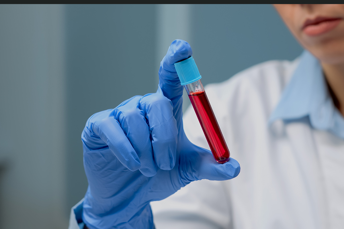  آزمایش خون چگونه اختلالات رایج در سالمندان را شناسایی می‌کند؟