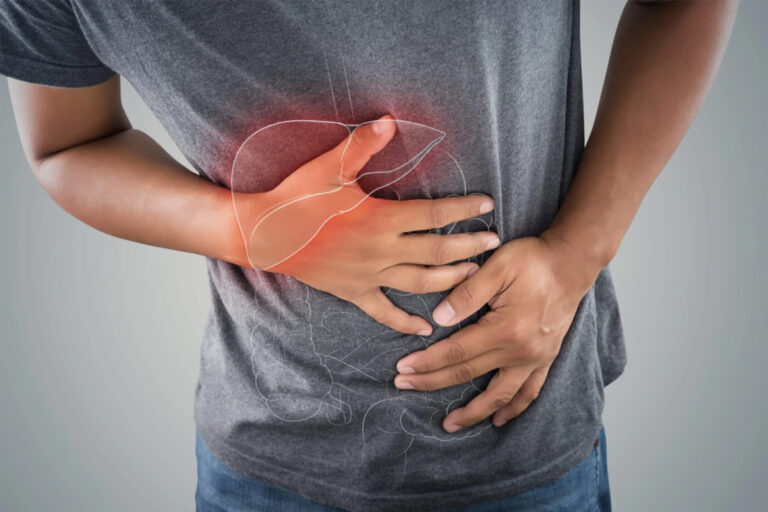 آزمایش هپاتیت چیست و چرا تجویز می‌شود؟