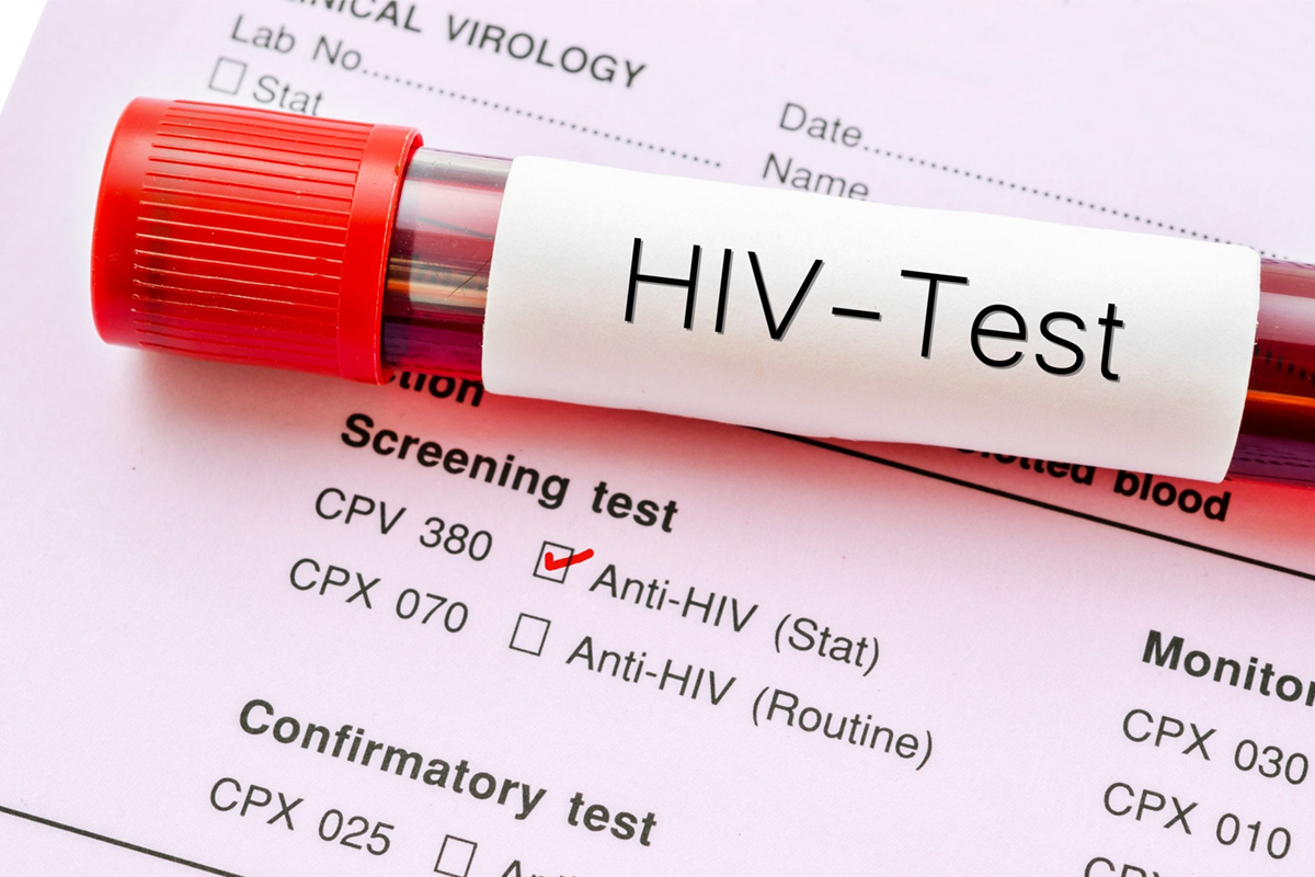  آنچه باید در مورد آزمایش HIV بدانیم