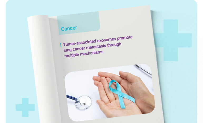  اگزوزوم چه نقشی در گسترش سرطان ریه دارد؟