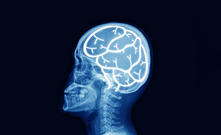  ضربه مغزی چیست و چگونه ایجاد می‌شود؟