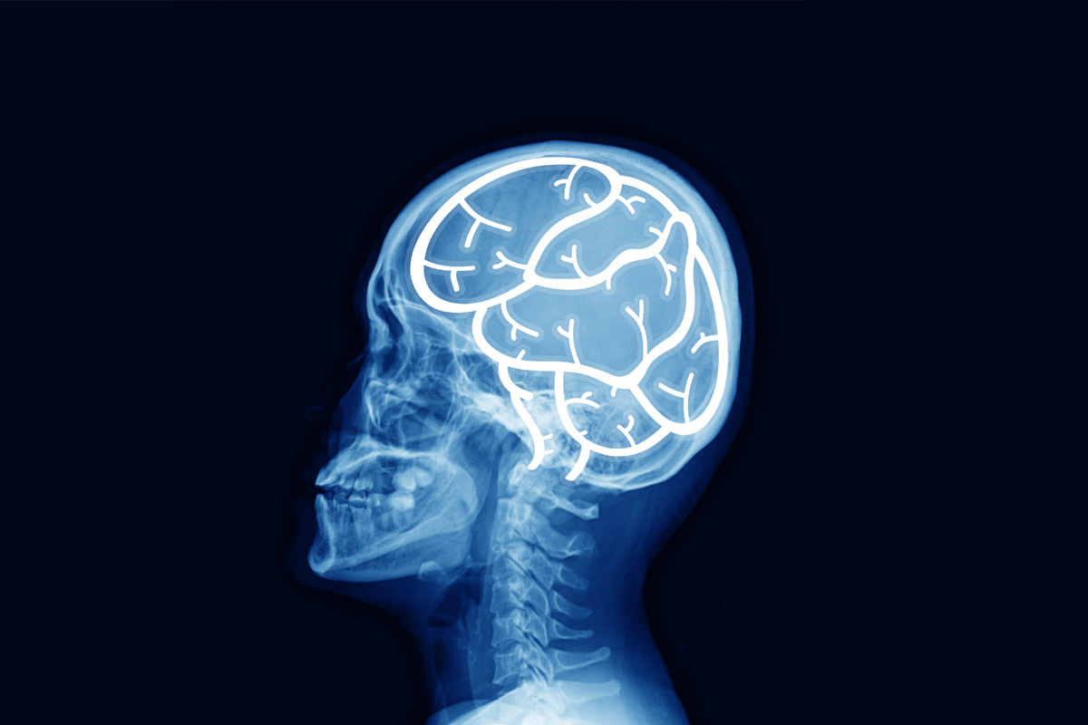 ضربه مغزی چیست و چگونه ایجاد می‌شود؟
