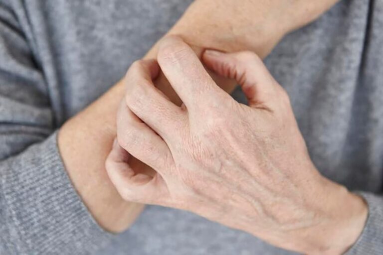 علائم اگزما چیست و چگونه باید با آن مقابله کنیم؟