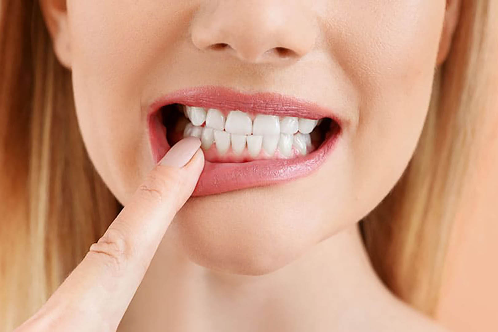 کاهش خطر پوسیدگی دندان