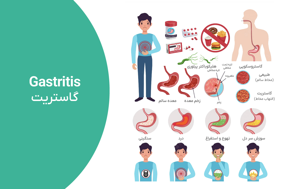 قرص مترونیدازول برای اسهال