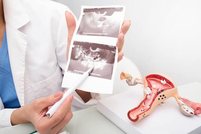سونوگرافی واژینال؛ آمادگی، کاربردها و عوارض