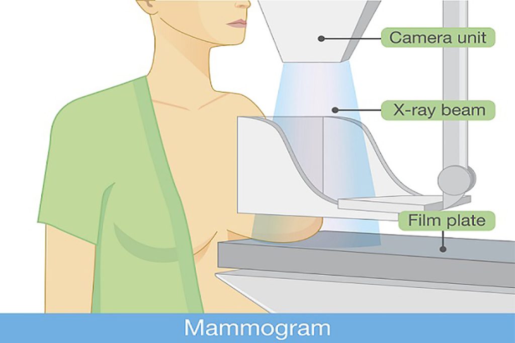 روش تصویربرداری ماموگرافی