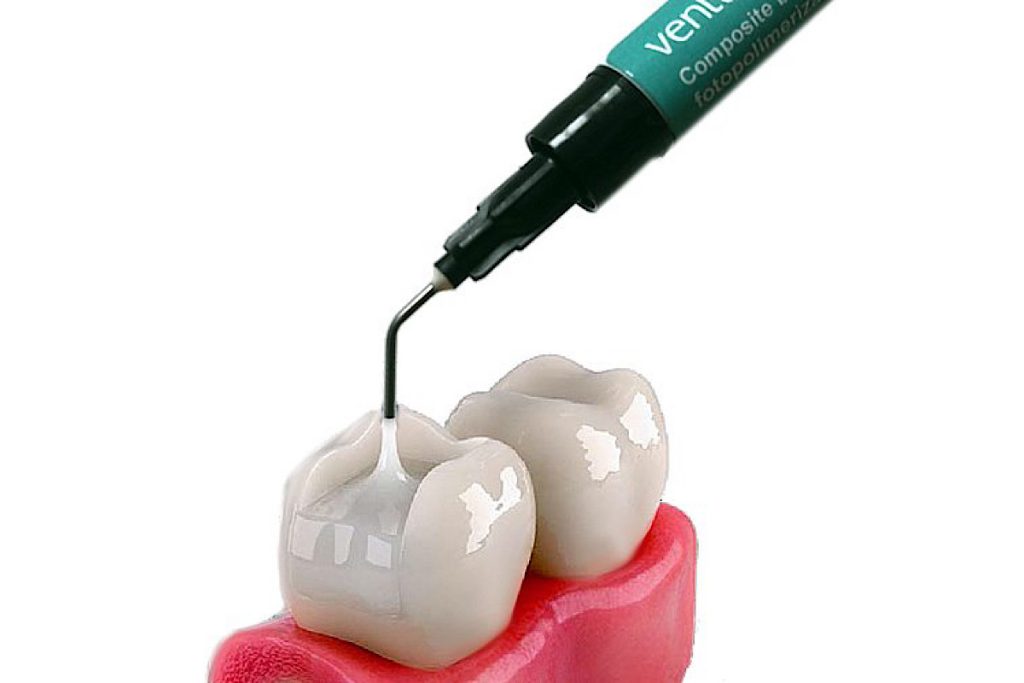ترکیب کامپوزیت دندان