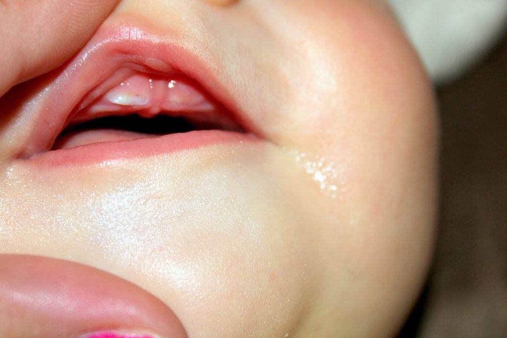 کاهش درد دندان درآوردن نوزاد